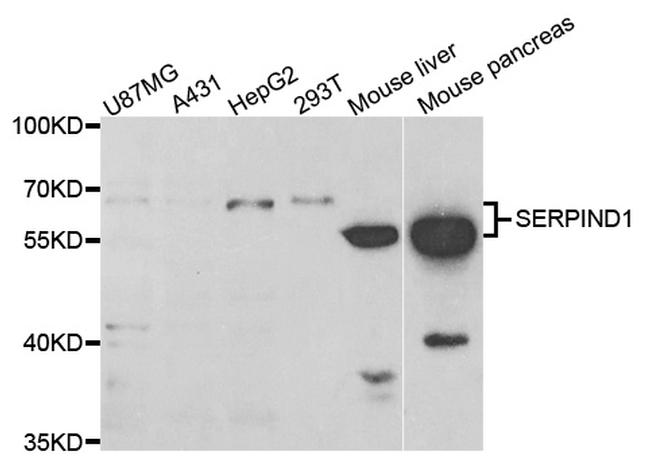 Heparin Cofactor II Antibody in Western Blot (WB)