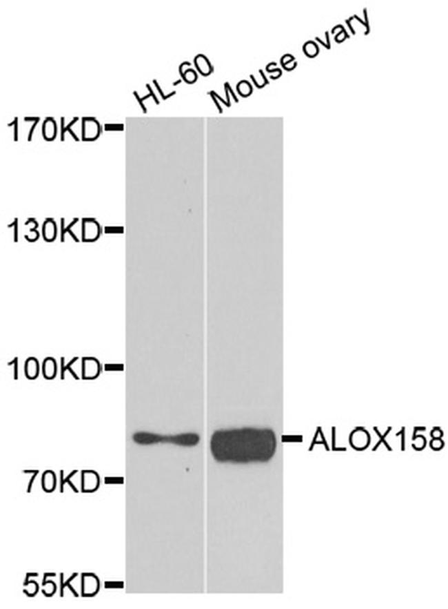 ALOX15B Antibody in Western Blot (WB)