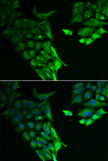 HABP2 Antibody in Immunocytochemistry (ICC/IF)