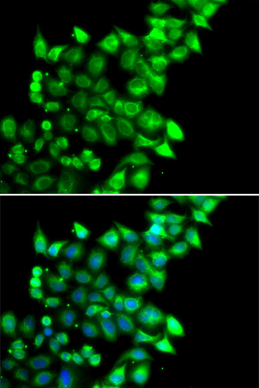 MEST Antibody in Immunocytochemistry (ICC/IF)