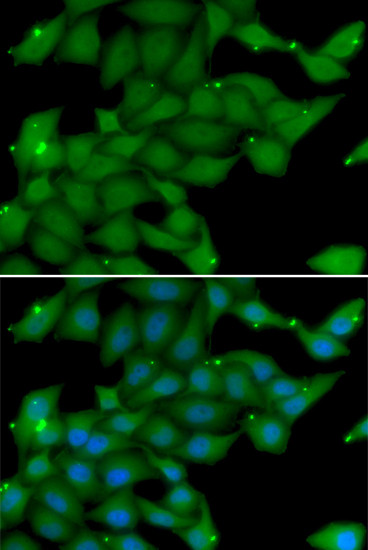 RASGRF1 Antibody in Immunocytochemistry (ICC/IF)