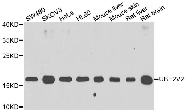 UBE2V2 Antibody in Western Blot (WB)