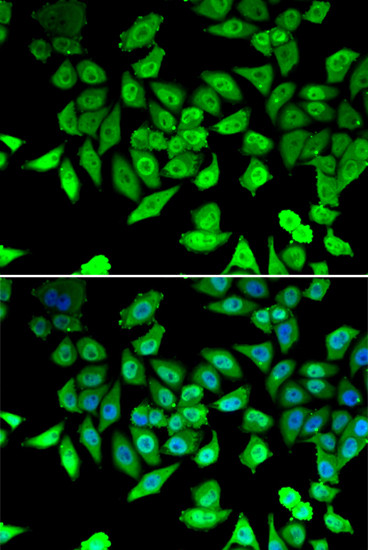 DBC1 Antibody in Immunocytochemistry (ICC/IF)