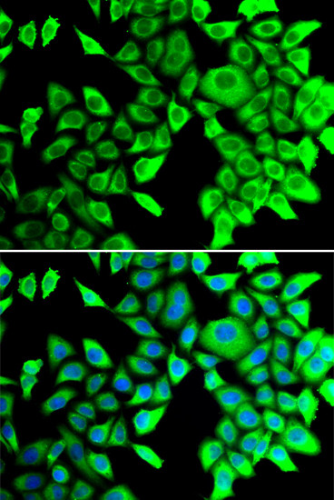 THADA Antibody in Immunocytochemistry (ICC/IF)