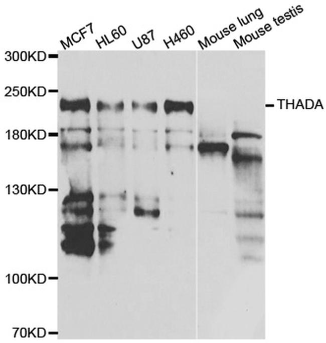 THADA Antibody in Western Blot (WB)