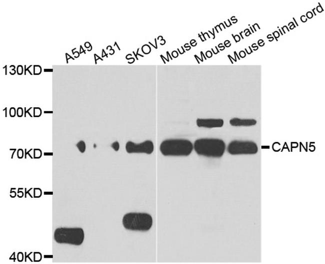 Calpain 5 Antibody in Western Blot (WB)