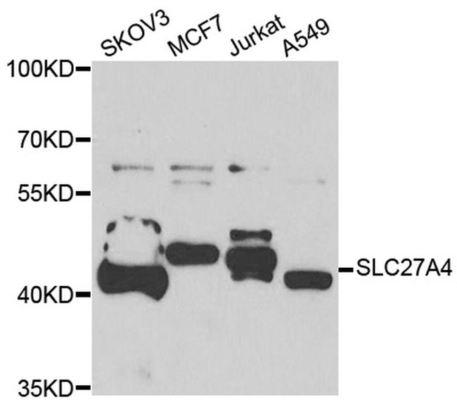 SLC27A4 Antibody in Western Blot (WB)