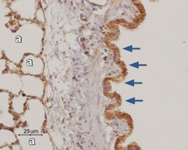 ADORA3 Antibody in Immunohistochemistry (Paraffin) (IHC (P))