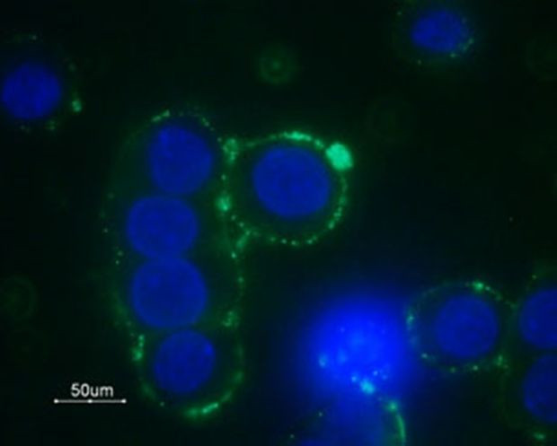 alpha-1b Adrenergic Receptor (extracellular) Antibody in Immunocytochemistry (ICC/IF)