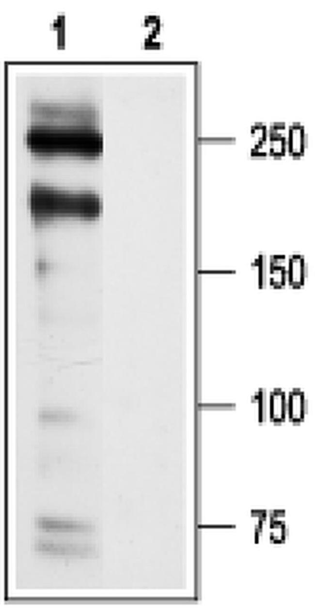 CaV1.2 Antibody in Western Blot (WB)