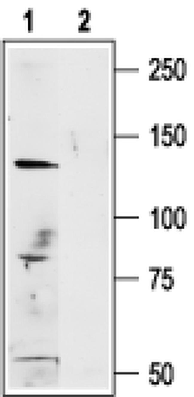 TRPM1 Antibody in Western Blot (WB)