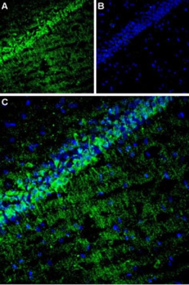 CACNG8 Antibody in Immunohistochemistry (IHC)