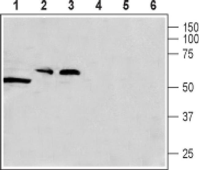 CACNG8 Antibody in Western Blot (WB)