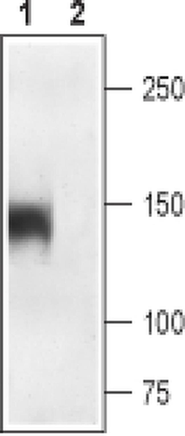 CaV1.1 (extracellular) Antibody in Western Blot (WB)