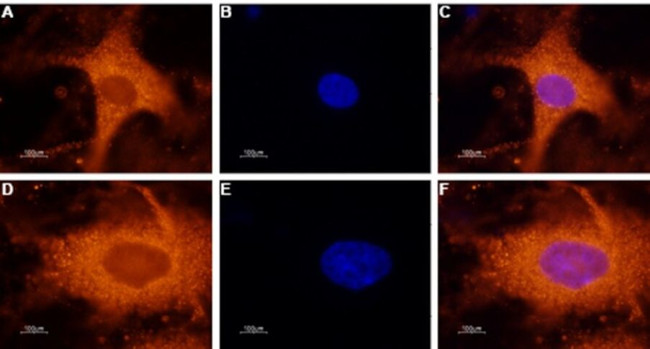 GALR1 Antibody in Immunocytochemistry (ICC/IF)