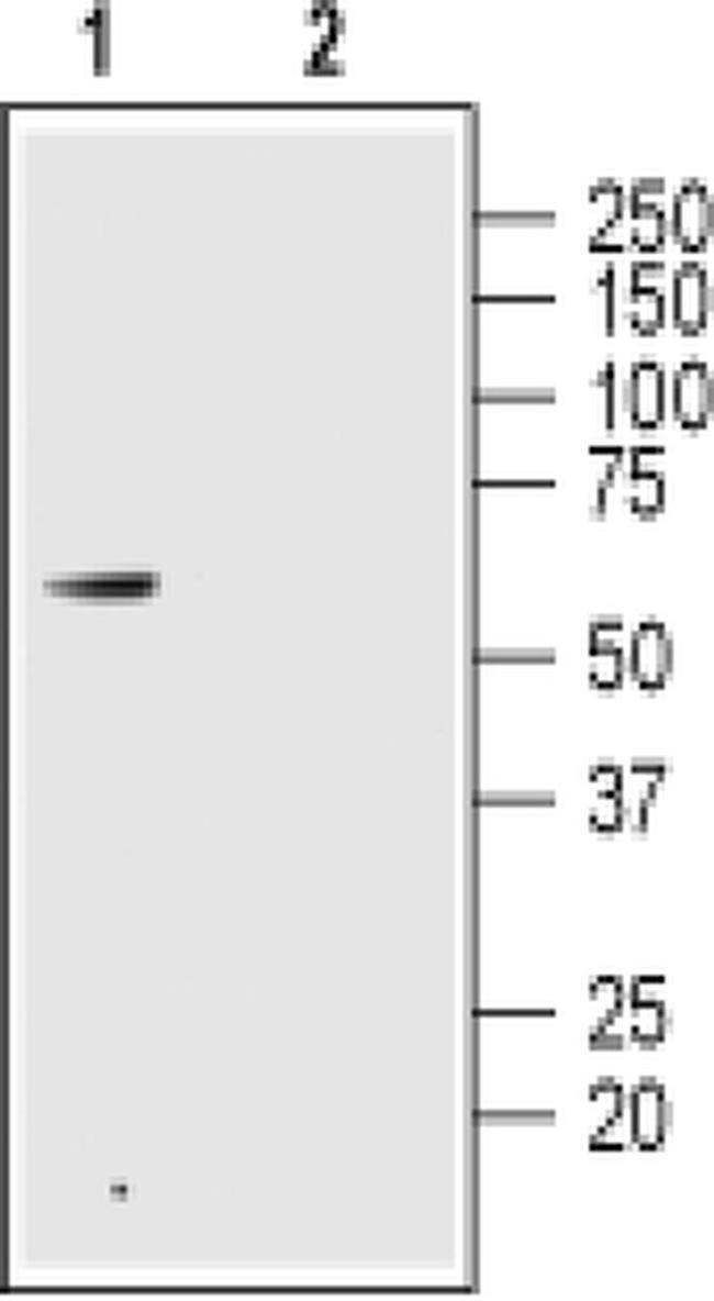 GLP2R (extracellular) Antibody in Western Blot (WB)