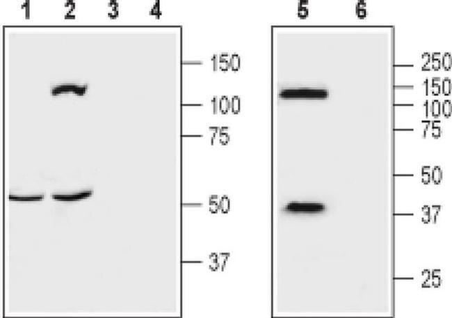 OPRK1 (extracellular) Antibody in Western Blot (WB)