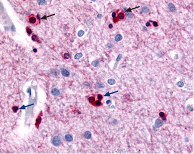 KCNN2 Antibody in Immunohistochemistry (IHC)