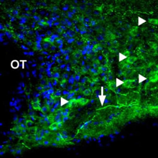 P2X1 Antibody in Immunohistochemistry (IHC)