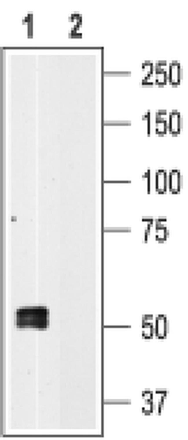 P2X1 Antibody in Western Blot (WB)