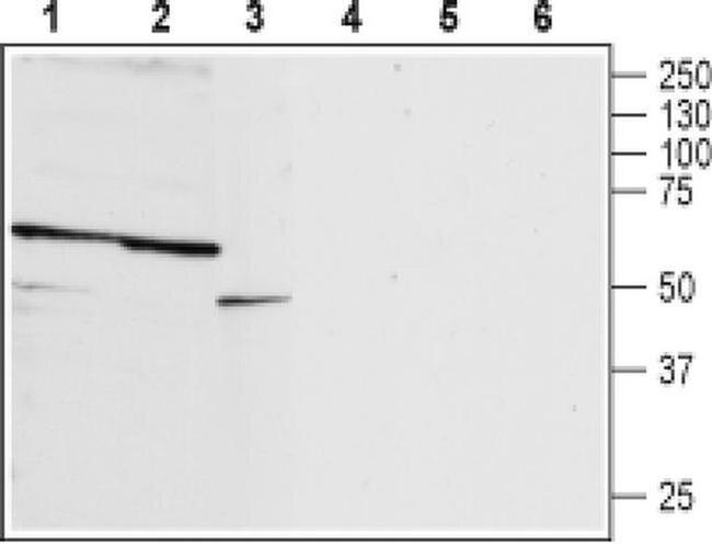 P2X2 (extracellular) Antibody in Western Blot (WB)