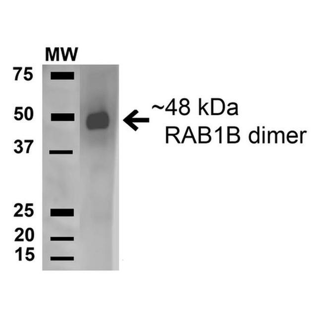 RAB1B Antibody in Western Blot (WB)