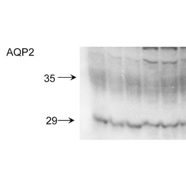 Aquaporin 2 Antibody in Western Blot (WB)