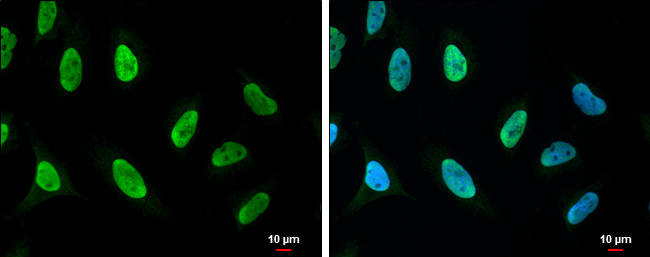 PARP1 (cleaved Asp214) Antibody in Immunocytochemistry (ICC/IF)