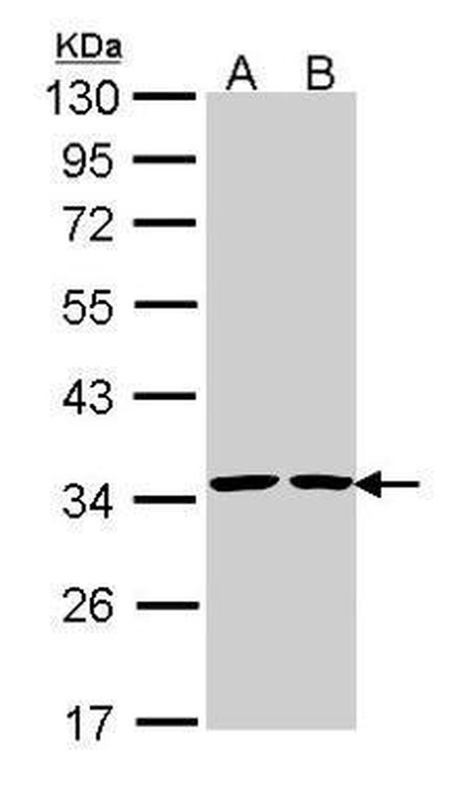 Annexin V Antibody in Western Blot (WB)