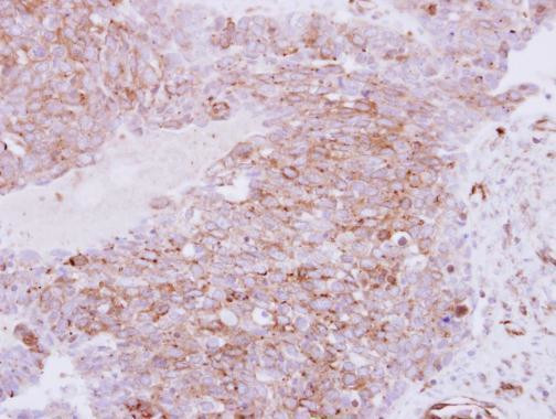 RhoC Antibody in Immunohistochemistry (Paraffin) (IHC (P))