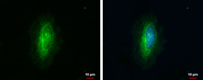 RhoGAP Antibody in Immunocytochemistry (ICC/IF)