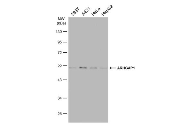 RhoGAP Antibody in Western Blot (WB)