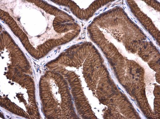 Axl Antibody in Immunohistochemistry (Paraffin) (IHC (P))