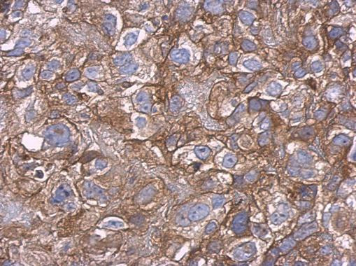 Carbonic Anhydrase IX Antibody in Immunohistochemistry (Paraffin) (IHC (P))