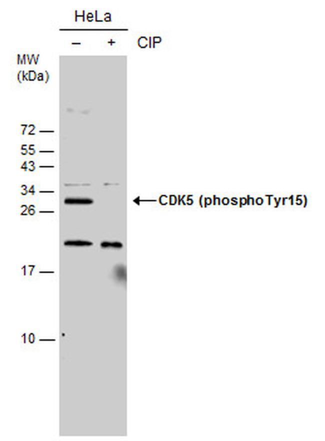 Phospho-CDK5 (Tyr15) Antibody in Western Blot (WB)