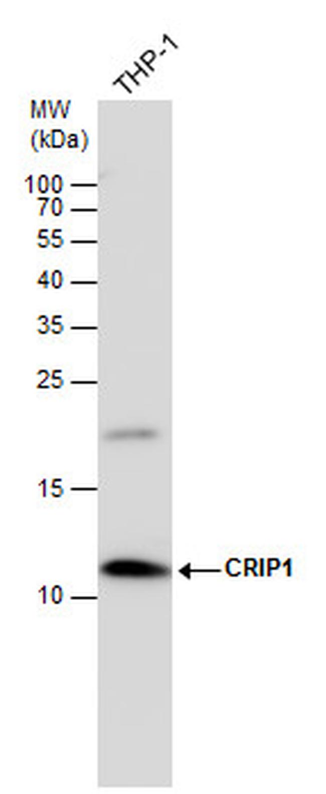 CRIP1 Antibody in Western Blot (WB)