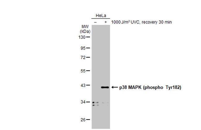 Phospho-p38 MAPK (Tyr182) Antibody in Western Blot (WB)