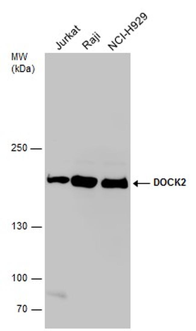 DOCK2 Antibody in Western Blot (WB)