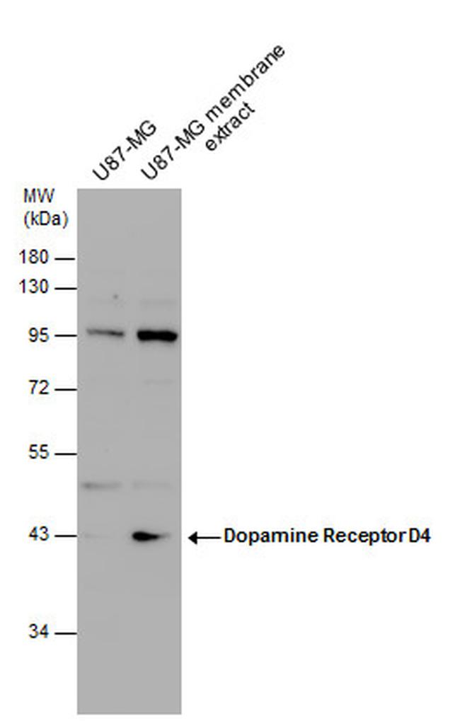 DRD4 Antibody in Western Blot (WB)