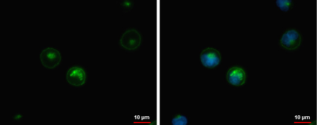 HLA-DQB1 Antibody in Immunocytochemistry (ICC/IF)