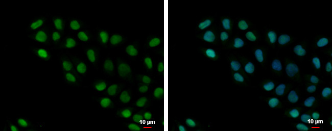 HMGB1/HMGB2 Antibody in Immunocytochemistry (ICC/IF)