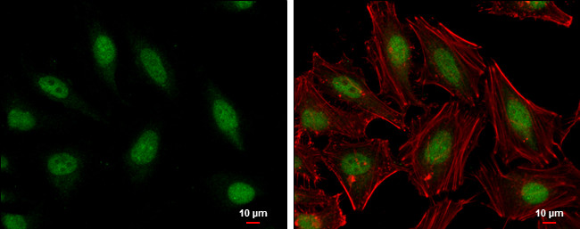 HMGB1/HMGB2 Antibody in Immunocytochemistry (ICC/IF)