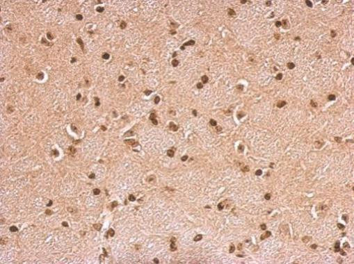 HMGB1/HMGB2 Antibody in Immunohistochemistry (Paraffin) (IHC (P))