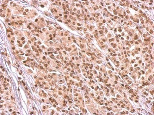 HMGB1/HMGB2 Antibody in Immunohistochemistry (Paraffin) (IHC (P))