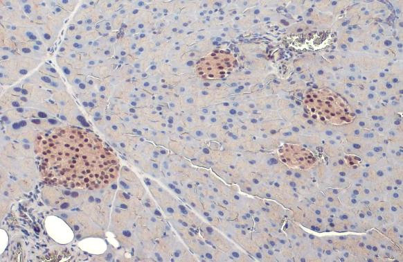 PDX1 Antibody in Immunohistochemistry (Paraffin) (IHC (P))