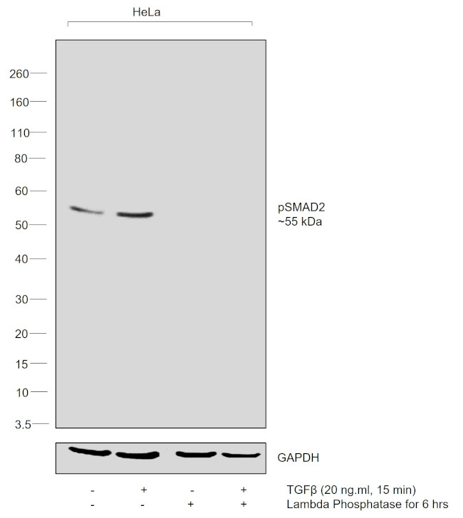 Phospho-SMAD2 (Ser245, Ser250, Ser255) Antibody
