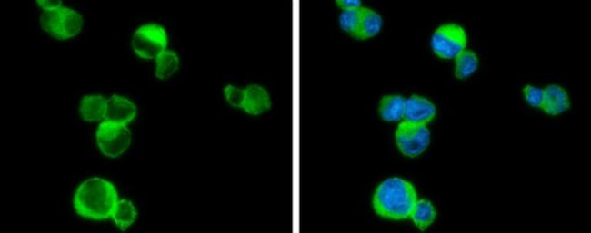 PLCB2 Antibody in Immunocytochemistry (ICC/IF)