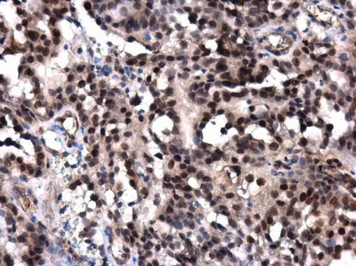 POLE Antibody in Immunohistochemistry (Paraffin) (IHC (P))