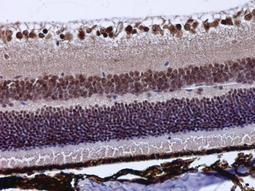 POU4F3 Antibody in Immunohistochemistry (Paraffin) (IHC (P))