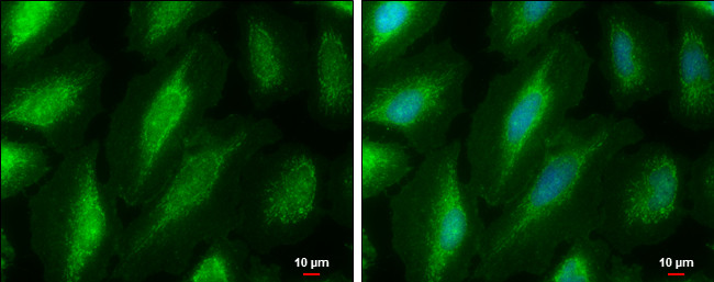 PKC mu Antibody in Immunocytochemistry (ICC/IF)